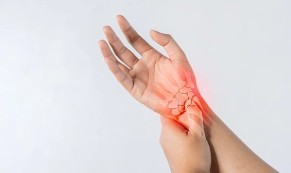 Arthritis