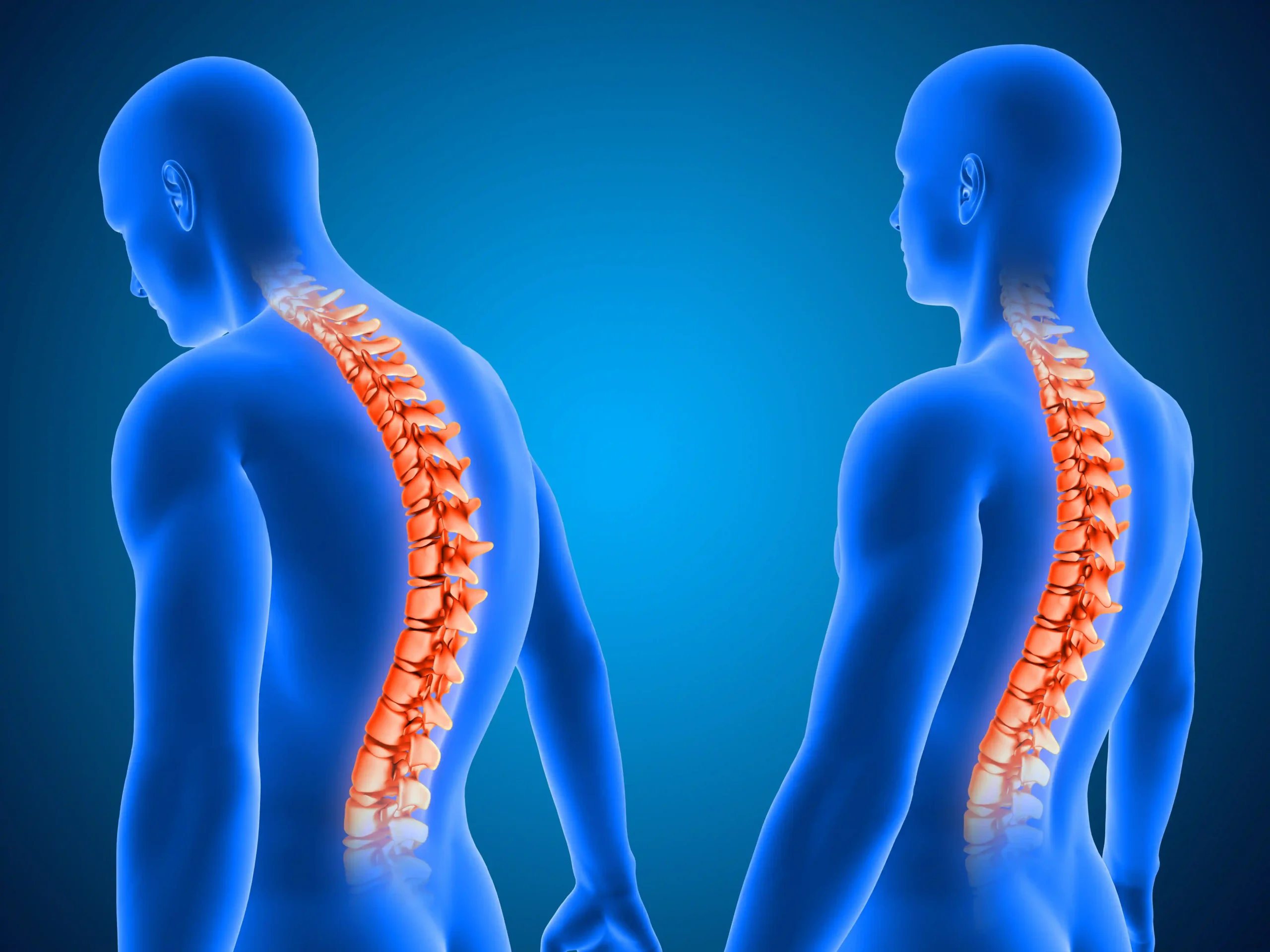 Herniated Disc Upper Back: Causes, Symptoms & Treatment Options 1 Symptoms of a Herniated Disc in Upper Back