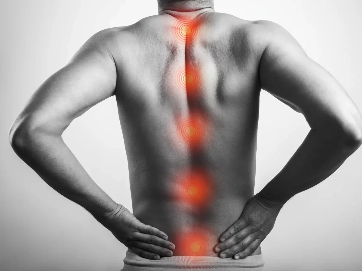 Burning Pain Low Back