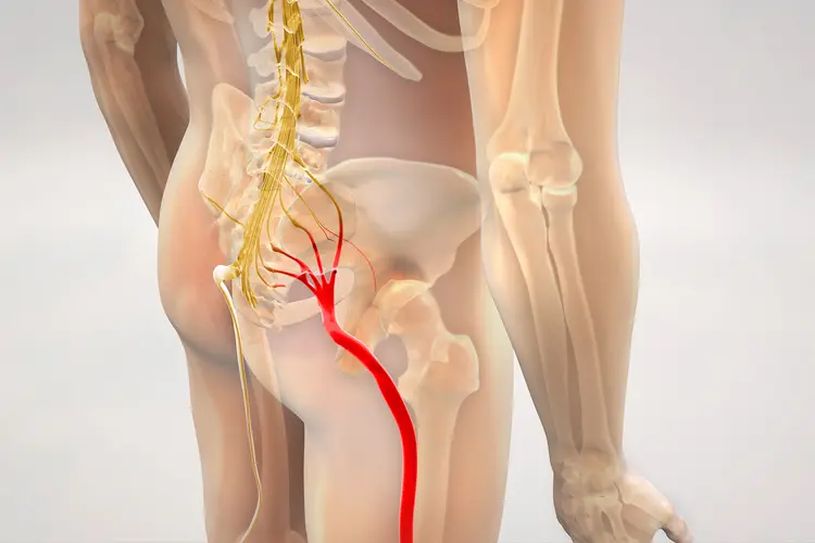 lower back pain radiating to leg