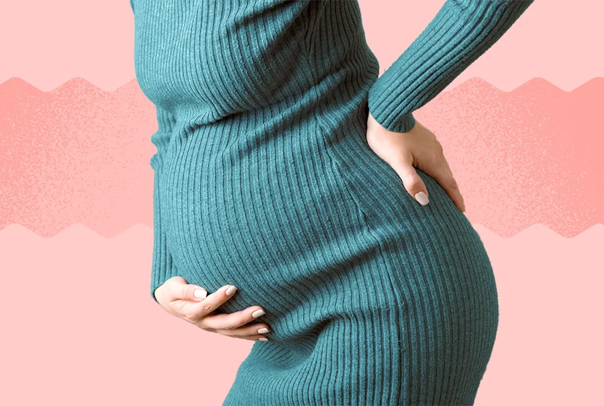 Sciatica During Pregnancy