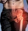 Famous People Who Have Suffered Hip Injuries