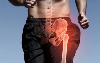 Famous People Who Have Suffered Hip Injuries Famous People Who Have Suffered Hip Injuries
